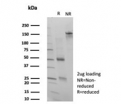 SDS-PAGE analysis of purified, BSA-free SATB1 antibody (clone PCRP-SATB1-2C3) as confirmation of integrity and purity.