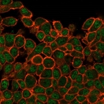 Immunofluorescent staining of PFA-fixed human HeLa cells with SATB1 antibody (green, clone PCRP-SATB1-2C3) and phalloidin (red).