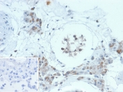 IHC staining of FFPE human testis tissue with GCSAM antibody (clone HGAL/2834). Inset: PBS used in place of primary Ab (secondary Ab negative control). HIER: boil tissue sections in pH 9 10mM Tris with 1mM EDTA for 20 min and allow to cool before testing.