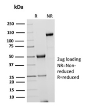SDS-PAGE analysis of purified, BSA-free CSTA antibody (clone rCSTA/8995) as confirmation of integrity and purity.