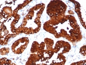 IHC staining of FFPE human prostate tissue with ZXDC antibody (clone PCRP-ZXDC-2B5). HIER: boil tissue sections in pH 9 10mM Tris with 1mM EDTA for 20 min and allow to cool before testing.