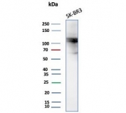 Western blot testing of human SK-BR-3 cell lysate with ADH1L1 antibody (clone ALDH1L1/7701). Predicted molecular weight ~98 kDa.