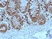 IHC staining of FFPE human colon tissue with ADH1L1 antibody (clone ALDH1L1/7702). HIER: boil tissue sections in pH 9 10mM Tris with 1mM EDTA for 20 min and allow to cool before testing.