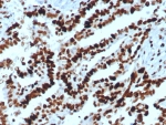 Western blot testing of human A431 cell lysate with MCM2 antibody. Commonly observed at 100-130 kDa.