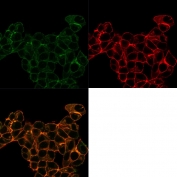 Immunofluorescent staining of PFA-fixed human MCF-7 cells with Lactotransferrin antibody (Green, clone LTF/4074); Red = Phalloidin; Yellow-Brown = superimposed.