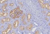 IHC staining of FFPE human kidney tissue with CD10 antibody (clone MME/8376R). HIER: boil tissue sections in pH 9 10mM Tris with 1mM EDTA for 20 min and allow to cool before testing.