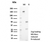 SDS-PAGE analysis of purified, BSA-free Transferrin antibody (clone TF/4796) as confirmation of integrity and purity.