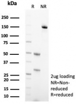SDS-PAGE analysis of purified, BSA-free Transferrin antibody (clone TF/4798) as confirmation of integrity and purity.