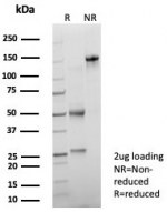 SDS-PAGE analysis of purified, BSA-free PSAP antibody (clone ACPP/8409R) as confirmation of integrity and purity.