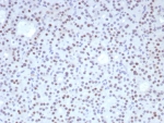 IHC staining of FFPE human parathyroid tissue with Forkhead box protein L2 antibody (clone FOXL2/8362R). HIER: boil tissue sections in pH 9 10mM Tris with 1mM EDTA for 20 min and allow to cool before testing.