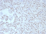 IHC staining of FFPE human parathyroid tissue with FOXL2 antibody (clone FOXL2/8701R). HIER: boil tissue sections in pH 9 10mM Tris with 1mM EDTA for 20 min and allow to cool before testing.