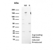 SDS-PAGE analysis of purified, BSA-free CD10 antibody (clone MME/4236) as confirmation of integrity and purity.