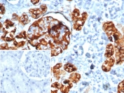 IHC staining of FFPE human kidney tissue with CD10 antibody (clone MME/4237). Inset: PBS used in place of primary Ab (secondary Ab negative control). HIER: boil tissue sections in pH 9 10mM Tris with 1mM EDTA for 20 min and allow to cool before testing.