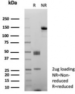 SDS-PAGE analysis of purified, BSA-free CD10 antibody (clone rMME/8584) as confirmation of integrity and purity.