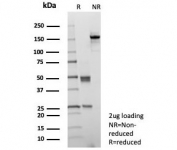 SDS-PAGE analysis of purified, BSA-free CD10 antibody (clone MME/8658R) as confirmation of integrity and purity.