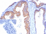 IHC staining of FFPE human tonsil tissue with CD38 antibody (clone CD38/8335R). Inset: PBS used in place of primary Ab (secondary Ab negative control). HIER: boil tissue sections in pH 9 10mM Tris with 1mM EDTA for 20 min and allow to cool before testing.