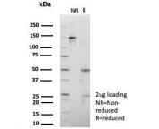 SDS-PAGE analysis of purified, BSA-free IGF2BP2 antibody (clone PCRP-IGF2BP2-1F9) as confirmation of integrity and purity.
