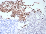 IHC staining of FFPE human tonsil tissue with B-Cell Lymphoma 6 antibody (clone BCL6/8808R). Inset: PBS used in place of primary Ab (secondary Ab negative control). HIER: boil tissue sections in pH 9 10mM Tris with 1mM EDTA for 20 min and allow to cool before testing.