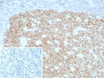 IHC staining of FFPE human tonsil tissue with BCL-6 antibody (clone BCL6/8928R). Inset: PBS used in place of primary Ab (secondary Ab negative control). HIER: boil tissue sections in pH 9 10mM Tris with 1mM EDTA for 20 min and allow to cool before testing.
