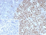 IHC staining of FFPE human tonsil tissue with BCL-6 antibody (clone BCL6/8983R). Inset: PBS used in place of primary Ab (secondary Ab negative control). HIER: boil tissue sections in pH 9 10mM Tris with 1mM EDTA for 20 min and allow to cool before testing.