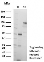 SDS-PAGE analysis of purified, BSA-free p63 antibody (clone rP40/8765) as confirmation of integrity and purity.