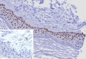 IHC staining of FFPE human skin tissue with TP63 antibody (clone TP63/7807R). Inset: PBS used in place of primary Ab (secondary Ab negative control). HIER: boil tissue sections in pH 9 10mM Tris with 1mM EDTA for 20 min and allow to cool before testing.