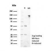 SDS-PAGE analysis of purified, BSA-free PGP9.5 antibody (clone UCHL1/8152) as confirmation of integrity and purity.