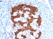 IHC staining of FFPE human pancreas tissue with PGP9.5 antibody (clone UCHL1/8152). HIER: boil tissue sections in pH 9 10mM Tris with 1mM EDTA for 20 min and allow to cool before testing.