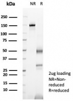 SDS-PAGE analysis of purified, BSA-free UchL1 antibody (clone rUCHL1/8057) as confirmation of integrity and purity.