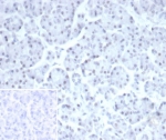 IHC staining of FFPE human pancreas tissue with Paired-like homeobox 2B antibody (clone PHOX2B/7792R). Inset: PBS used in place of primary Ab (secondary Ab negative control). HIER: boil tissue sections in pH 9 10mM Tris with 1mM EDTA for 20 min and allow to cool before testing.