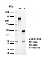 SDS-PAGE analysis of purified, BSA-free PGP9.5 antibody (clone UCHL1/7076R) as confirmation of integrity and purity.