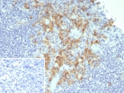IHC staining of FFPE human tonsil tissue with CD38 antibody (clone rCD38/8045). Inset: PBS used in place of primary Ab (secondary Ab negative control). HIER: boil tissue sections in pH 9 10mM Tris with 1mM EDTA for 20 min and allow to cool before testing.