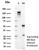 SDS-PAGE analysis of purified, BSA-free CD38 antibody (clone rCD38/8045) as confirmation of integrity and purity.