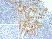 IHC staining of FFPE human tonsil tissue with CD38 antibody (clone rCD38/8045). Inset: PBS used in place of primary Ab (secondary Ab negative control). HIER: boil tissue sections in pH 9 10mM Tris with 1mM EDTA for 20 min and allow to cool before testing.