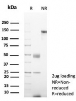 SDS-PAGE analysis of purified, BSA-free CD38 antibody (clone rCD38/6982) as confirmation of integrity and purity.