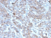IHC staining of FFPE human adrenal gland tissue with Interleukin-2 antibody (clone IL2/4985). HIER: boil tissue sections in pH 9 10mM Tris with 1mM EDTA for 20 min and allow to cool before testing.