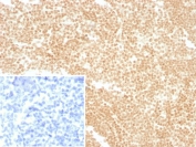 IHC staining of FFPE human tonsil tissue with LDB2 antibody (clone PCRP-LDB2-1B10). Inset: PBS used in place of primary Ab (secondary Ab negative control). HIER: boil tissue sections in pH 9 10mM Tris with 1mM EDTA for 20 min and allow to cool before testing.