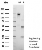 SDS-PAGE analysis of purified, BSA-free PDGFRA antibody (clone PDGFRA/7407) as confirmation of integrity and purity.