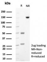 SDS-PAGE analysis of purified, BSA-free c-Kit antibody (clone C117/8399R) as confirmation of integrity and purity.