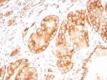 IHC staining of FFPE human brain tissue with Osteopontin antibody (clone OSP/8693R). HIER: boil tissue sections in pH 9 10mM Tris with 1mM EDTA for 20 min and allow to cool before testing.