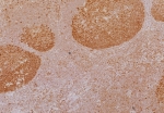 IHC staining of FFPE human tonsil tissue with TCF1 alpha antibody (clone LEF1/6764). HIER: boil tissue sections in pH 9 10mM Tris with 1mM EDTA for 20 min and allow to cool before testing.
