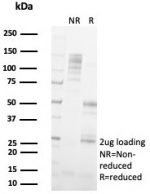 SDS-PAGE analysis of purified, BSA-free FABP2 antibody (clone FABP2/7669) as confirmation of integrity and purity.