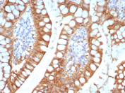I-FABP Antibody Small Intestine IHC. Immunohistochemistry staining of FFPE human small intestine tissue with I-FABP antibody (clone FABP2/7670). HIER: boil tissue sections in pH 9 10mM Tris with 1mM EDTA for 20 min and allow to cool before testing.
