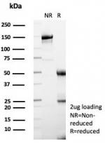 SDS-PAGE analysis of purified, BSA-free I-FABP antibody (clone FABP2/7670) as confirmation of integrity and purity.