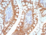IHC staining of FFPE human small intestine tissue with I-FABP antibody (clone FABP2/7670). HIER: boil tissue sections in pH 9 10mM Tris with 1mM EDTA for 20 min and allow to cool before testing.