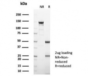SDS-PAGE analysis of purified, BSA-free Interleukin-2 antibody (clone IL2/4988) as confirmation of integrity and purity.