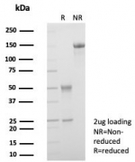 SDS-PAGE analysis of purified, BSA-free bFGF antibody (clone FGF2/7364) as confirmation of integrity and purity.