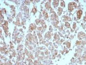 IHC staining of FFPE human adrenal gland tissue with Interleukin-2 antibody (clone IL2/8712). HIER: boil tissue sections in pH 9 10mM Tris with 1mM EDTA for 20 min and allow to cool before testing.