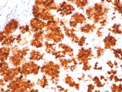 IHC staining of FFPE human stomach tissue with Interleukin-2 antibody (clone IL2/4983). HIER: boil tissue sections in pH 9 10mM Tris with 1mM EDTA for 20 min and allow to cool before testing.