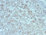 IHC staining of FFPE human adrenal gland tissue with Interleukin-15 antibody (clone rIL15/8049). HIER: boil tissue sections in pH 9 10mM Tris with 1mM EDTA for 20 min and allow to cool before testing.